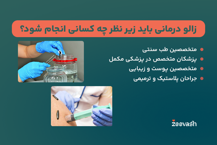 زالودرمانی باید زیر نظر چه کسانی انجام شود؟